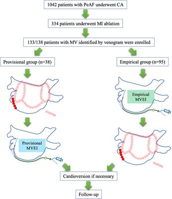 The impact of empirical Marshall vein ethanol infusion as a first-choice intraoperative strategy on the long-term outcomes in patients with persistent atrial fibrillation undergoing mitral isthmus ablation